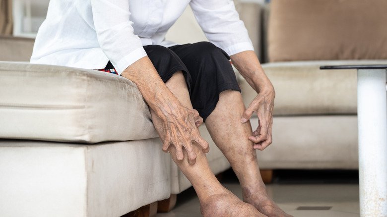 Une femme âgée se gratte les jambes