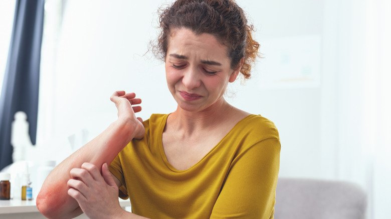 Une jeune femme triste se gratte les éruptions cutanées