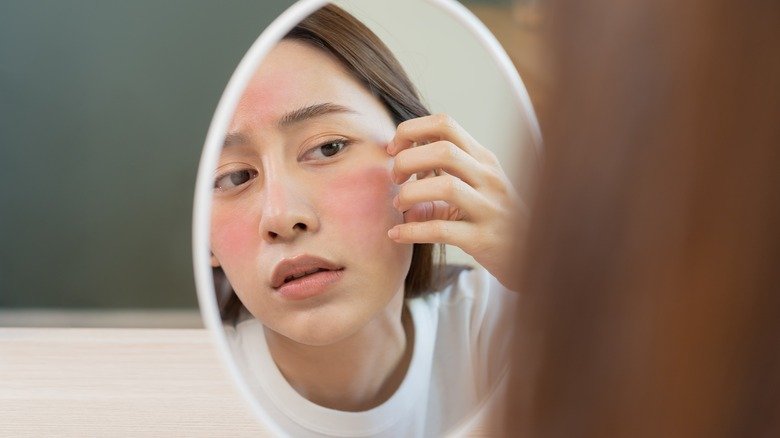 Une femme regarde une éruption cutanée dans un miroir