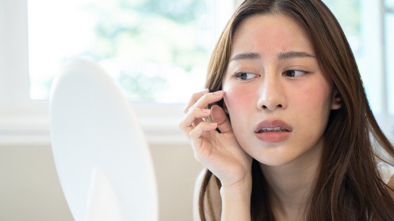 femme avec de l'eczéma sur le visage