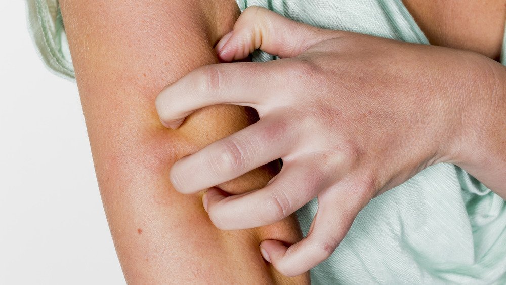 Une femme se gratte le bras qui la démange