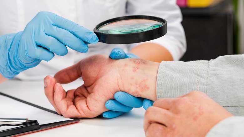 professionnel de la santé examinant le poignet d'un patient 