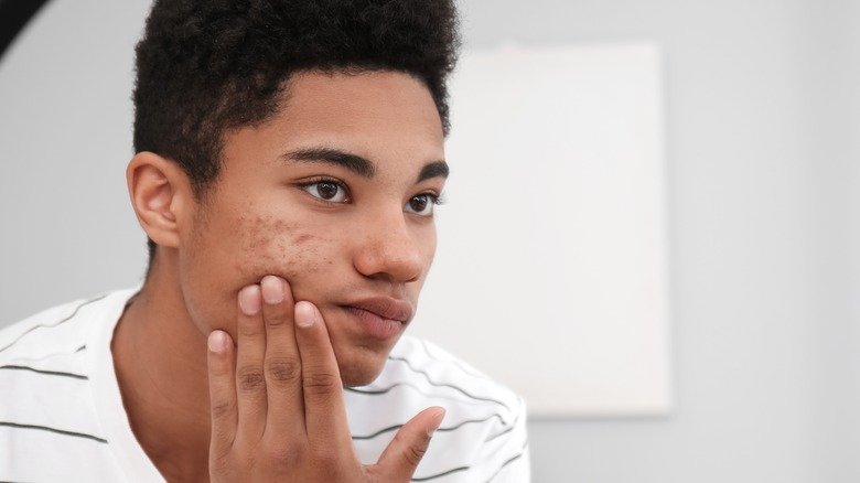 Un adolescent examine son acné dans un miroir