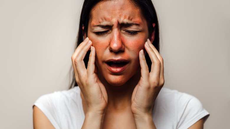 Femme atteinte de phototoxicité