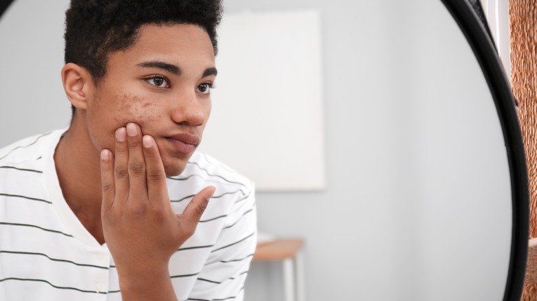 adolescent avec de l'acné