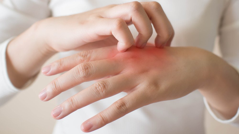 Éruptions cutanées sur les mains dues au lavage des mains