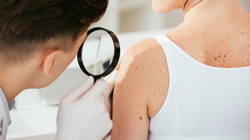 Dermatologue examinant la peau d'une femme